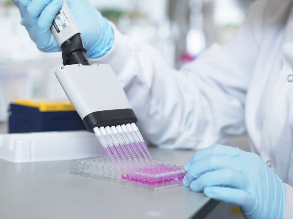 Human Ceruloplasmin ELISA Kit   